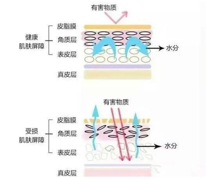 干、癢、紅、腫？別慌涂護膚品，先看看皮膚屏